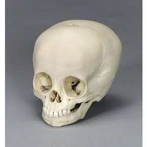 Bones Clones(r) Human Child Skull, 2 1/2 year old:  