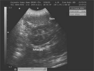 Echographe portable scanner convex sonde ultrasound  