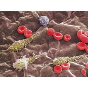  Red and White Blood Cells in a Portal Vein Photographic 