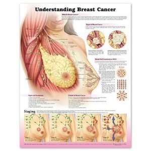 Understanding Breast Cancer Chart/Poster  Industrial 