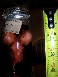 CONJOINED TWINS FETUS IN A JAR,SIDESHOW GAFF