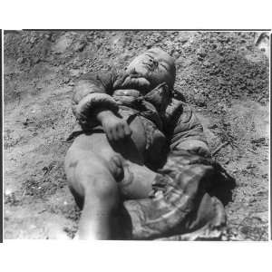   War,1937 1945,close up of small child killed by bomb